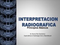 Image of INTERPRETACION RADIOGRÁFICO Principios Básicos