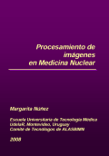 Procesamiento de imágenes en Medicina Nuclear
