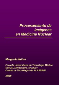 Image of Procesamiento de imágenes en Medicina Nuclear