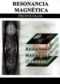 Image of RESONANCIA MAGNÉTICA