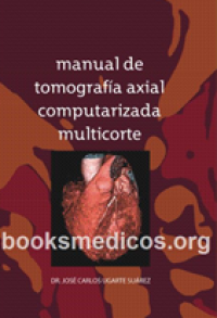 Image of manual de tomografía axial computarizada multicorte