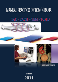Image of MANUAL PRACTICO DE TOMOGRAFIA