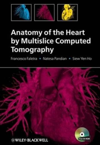 Image of Anatomía del corazón mediante tomografía computarizada multicorte