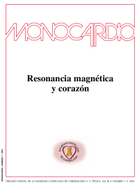 Image of Resonancia magnética y corazón