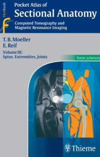 Image of Tomografía computarizada y resonancia magnética